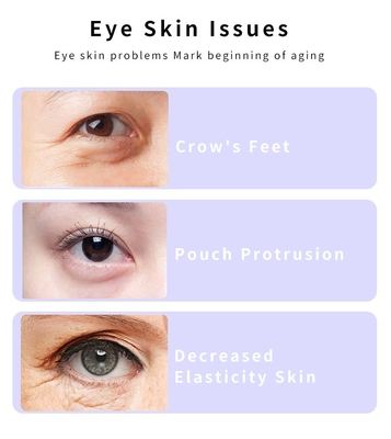 Perawatan Kesehatan Pribadi 155*18.3*23.4 mm Rotasi Mikrokurrent Ems Eye Massager Pen Wand