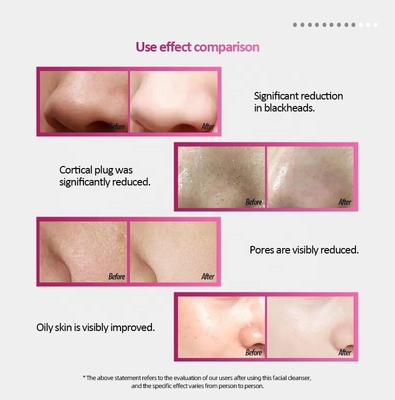 130*56*28 Sikat Cuci Wajah Silikon dengan Pengisian Tanpa Kabel dan Pijat Waterproof IPX6